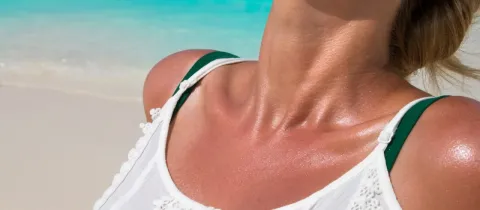 Gros plan sur les épaules et le cou d'une femme, au soleil sur une plage de sable blanc.