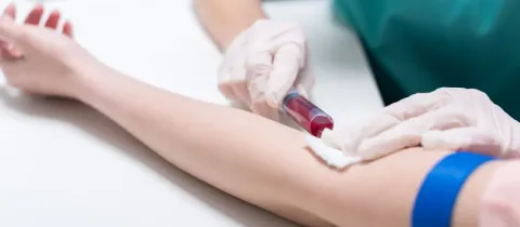 Un professionnel de la santé prélève du sang d'un bras à l'aide d'une aiguille et d'une fiole.