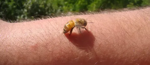 Une abeille est posée sur la peau du bras, prête à piquer ou venant de le faire.