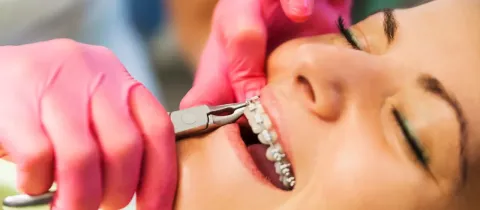 Orthodontiste ajustant l'appareil dentaire d'une patiente.
