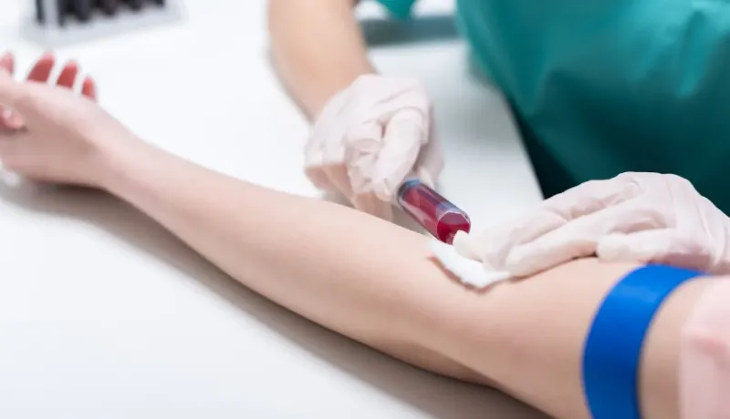 Un professionnel de la santé prélève du sang d'un bras à l'aide d'une aiguille et d'une fiole.