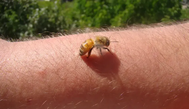 Une abeille est posée sur la peau du bras, prête à piquer ou venant de le faire.