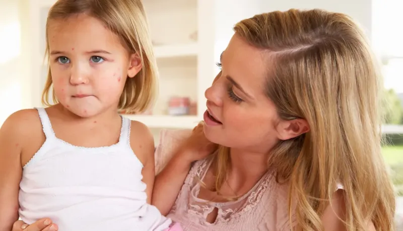 Mère réconfortant sa fille présentant une éruption cutanée.