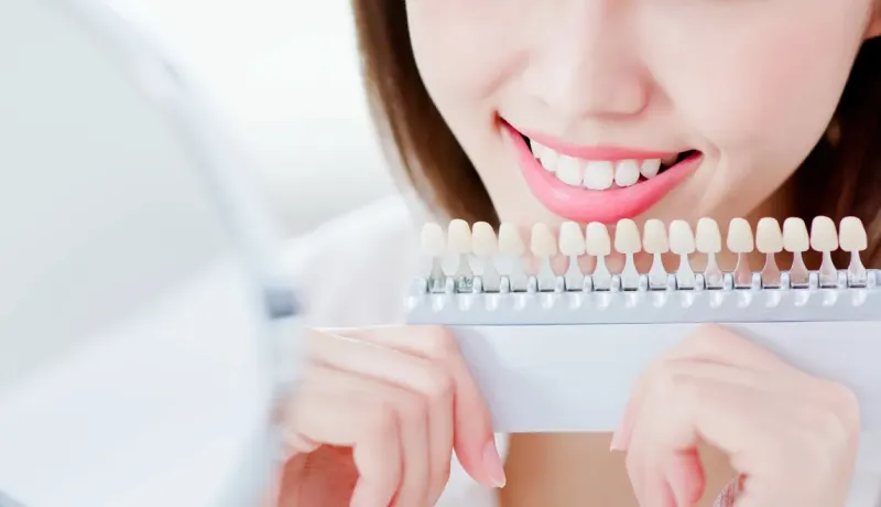 Femme souriante comparant ses dents à un nuancier, blanchiment.