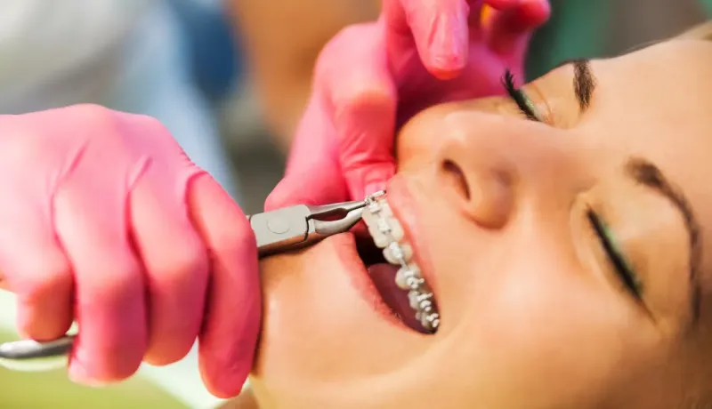 Orthodontiste ajustant l'appareil dentaire d'une patiente.