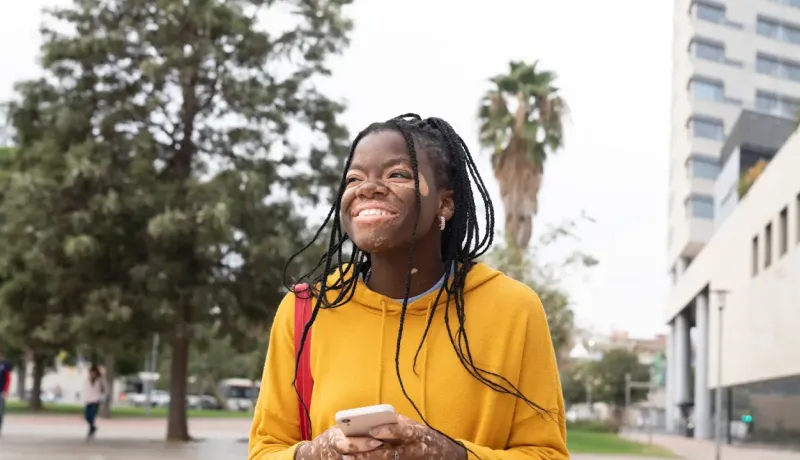 Jeune femme atteinte de vitiligo, souriante, utilisant son téléphone.